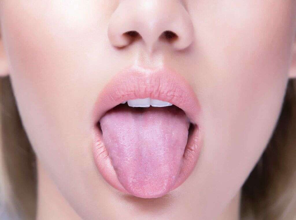 Mouth Cancer
