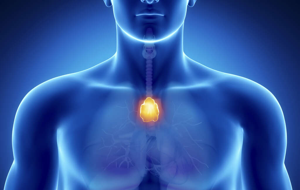 Myasthenia Gravis