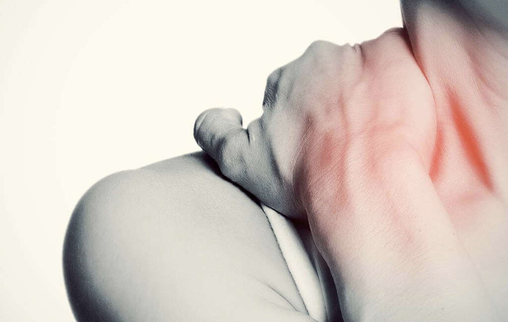 Myofascial Pain Syndrome