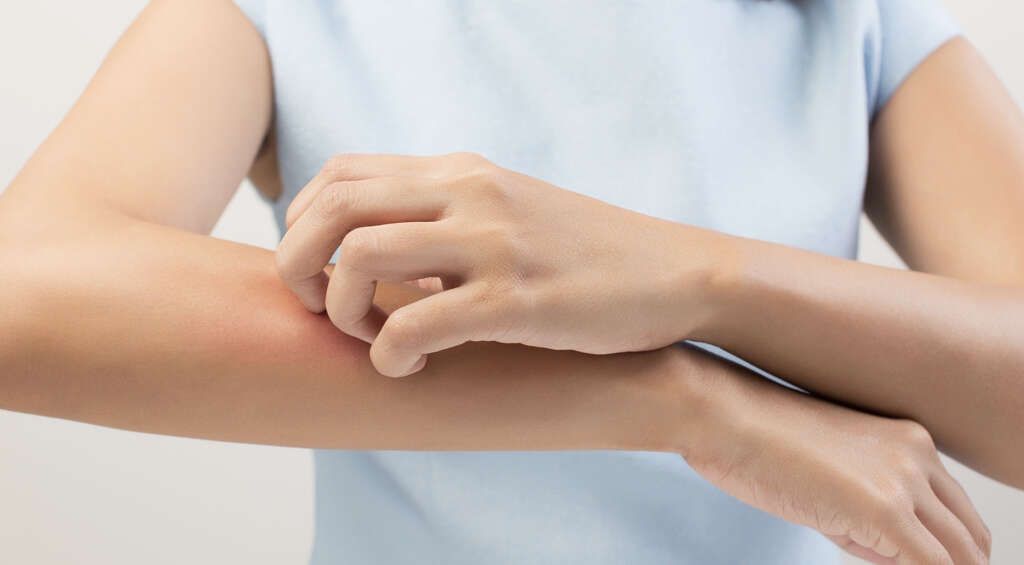 Necrotizing Fasciitis