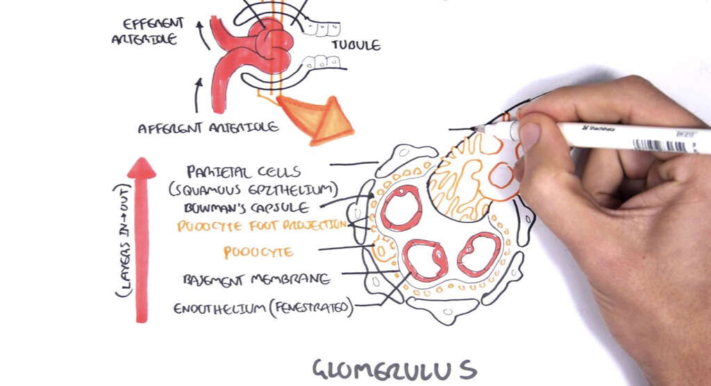 Nephrotic Syndrome