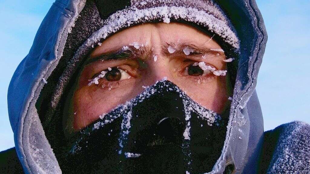Body Temperature