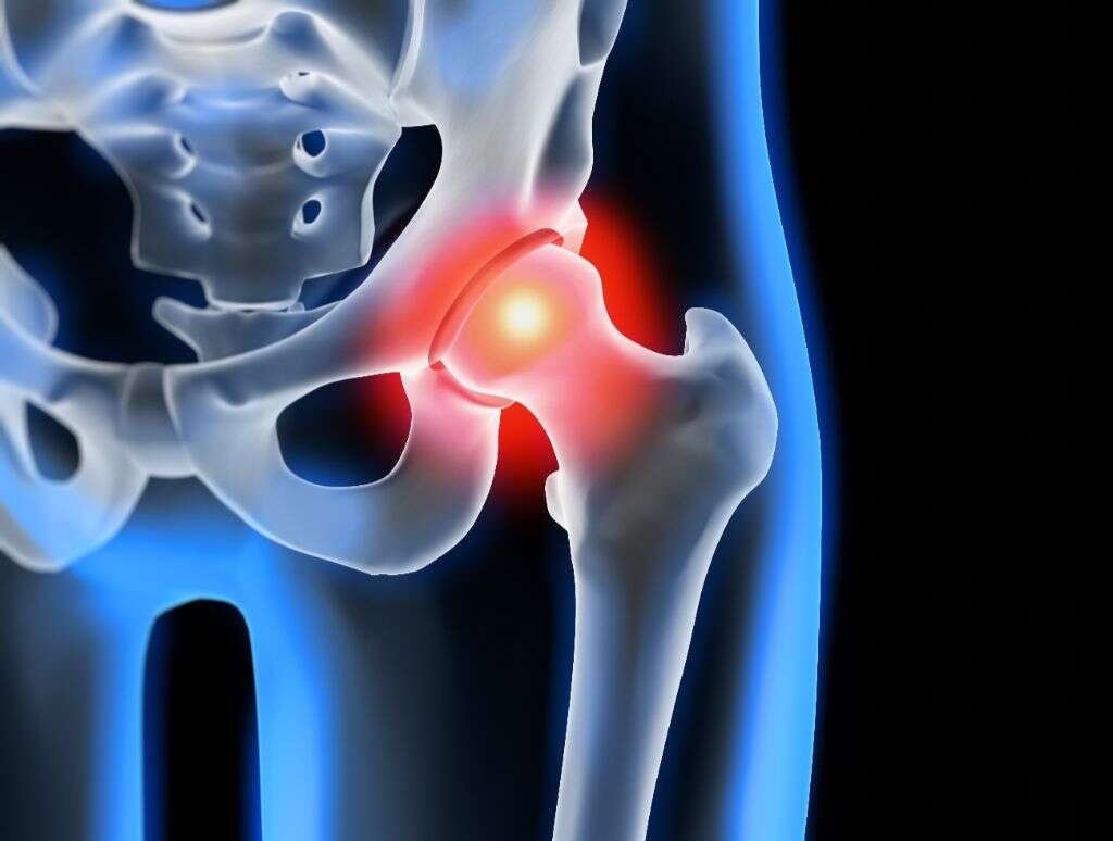 Osteoarthritis