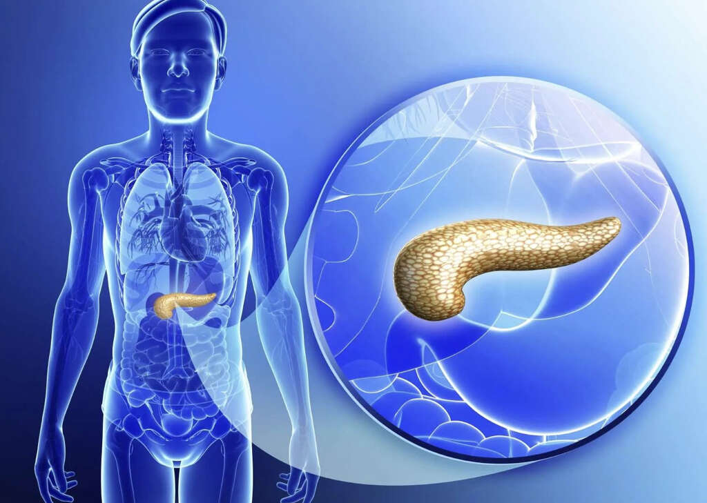 Pancreatic Cancer