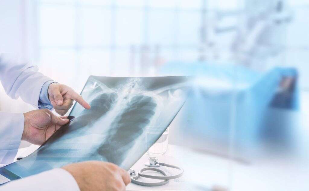 Parainfluenza