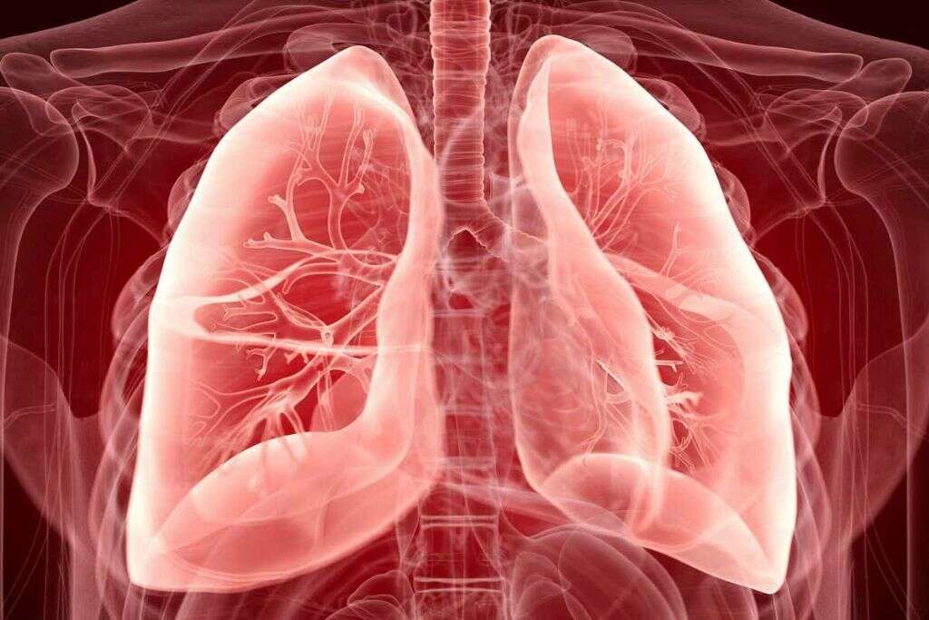 Pleural Effusion