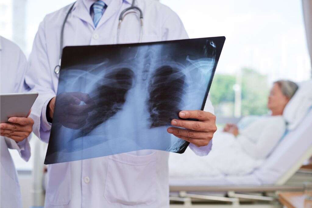 Pneumonia