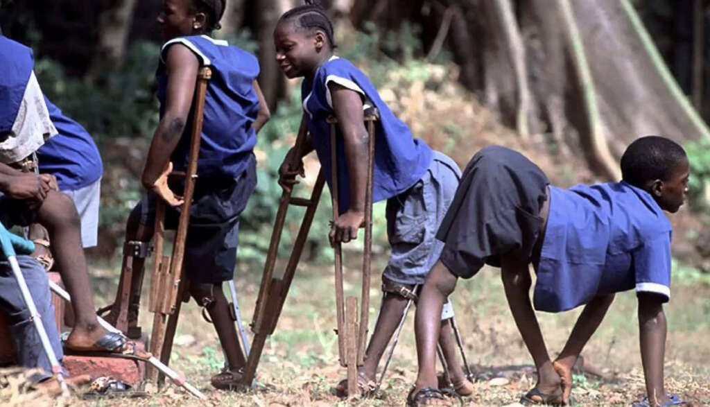 Polio