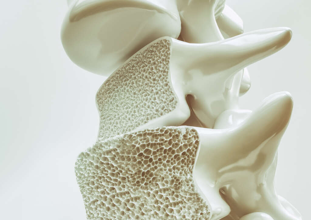 Post Polio Syndrome