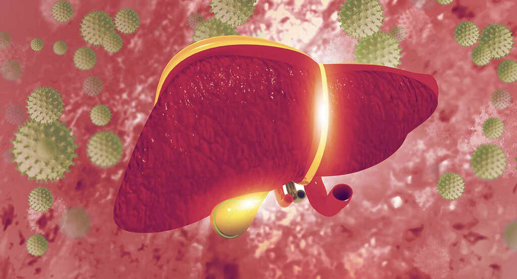 Primary Biliary Cirrhosis