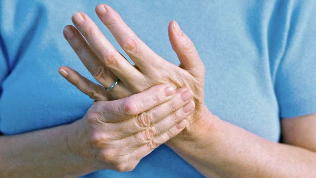 Psoriatic Arthritis
