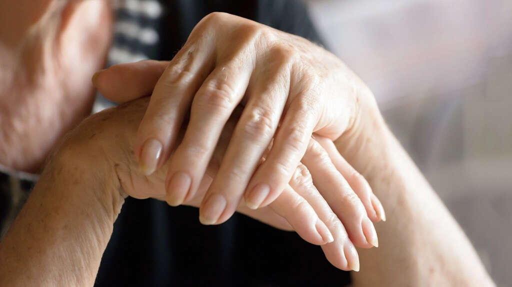 Psoriatic Arthritis
