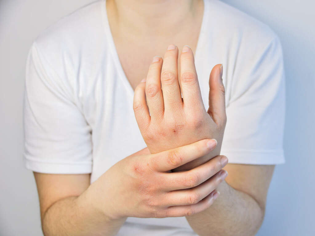 Psoriatic Arthritis