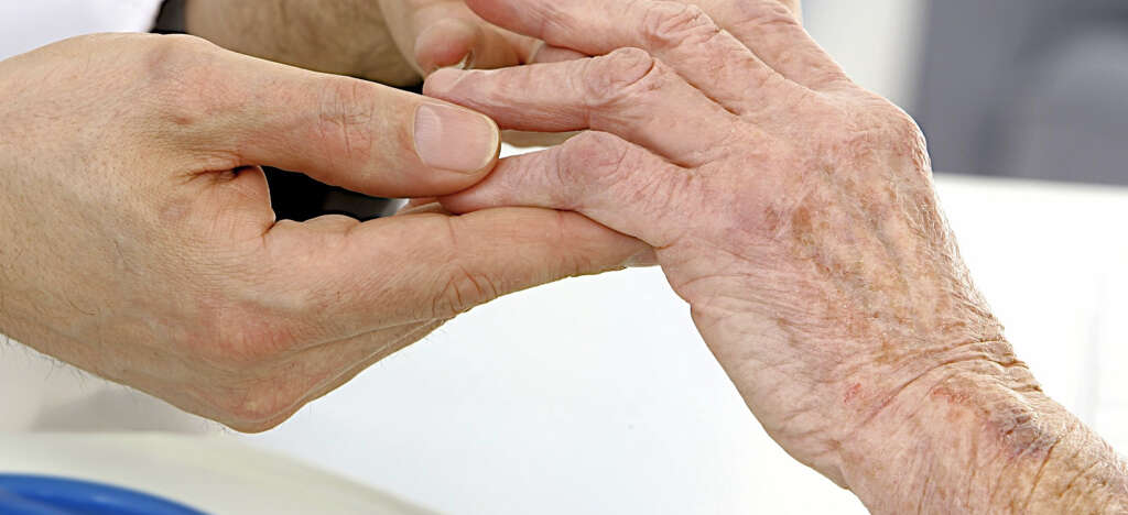 Raynaud's Syndrome