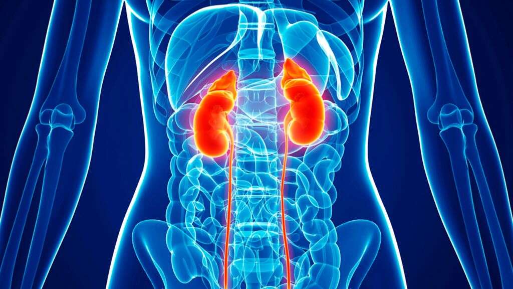 Renal Failure