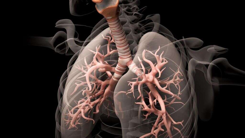 Respiratory Acidosis