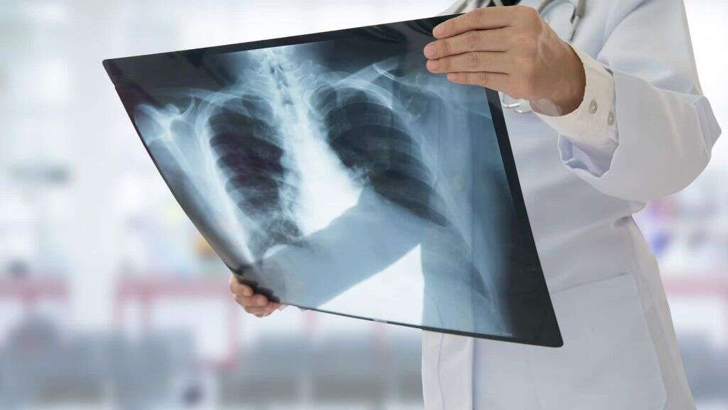Respiratory Distress