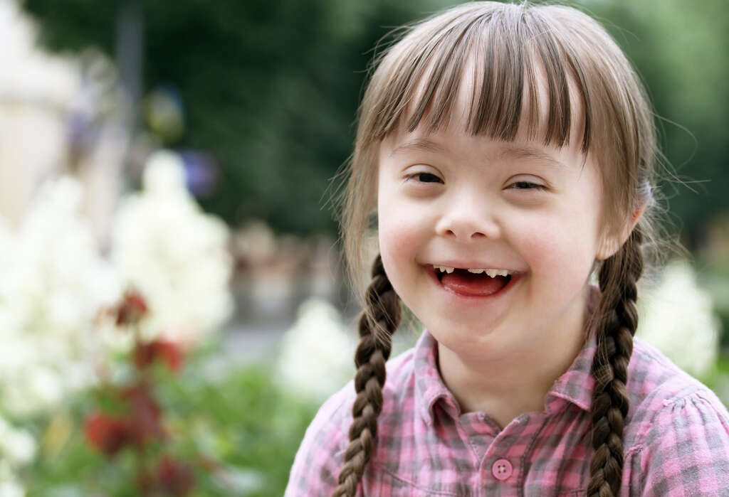 Rett Syndrome