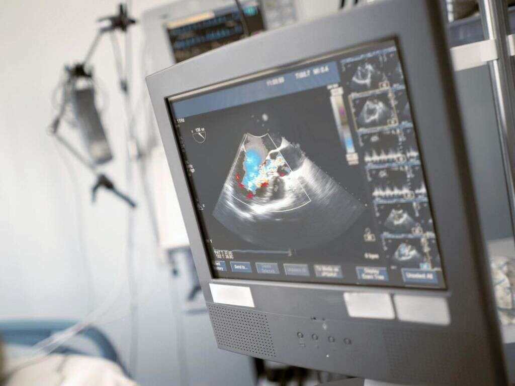 Rheumatic Heart Disease