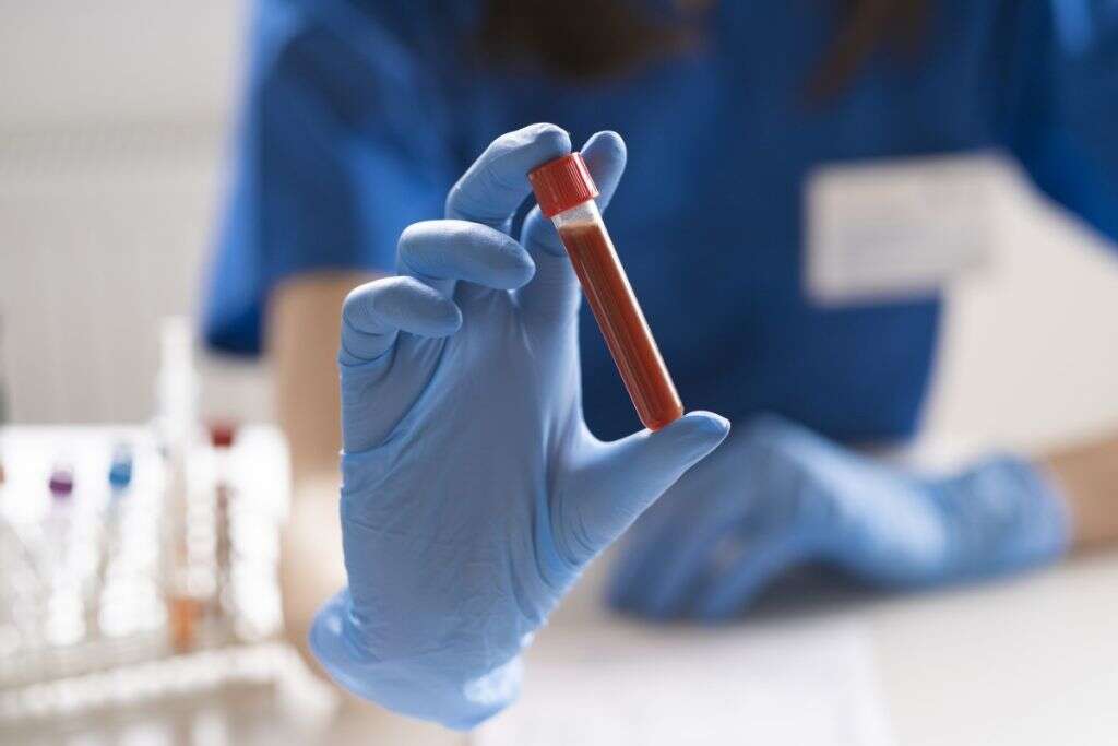 Rocky Mountain Spotted Fever