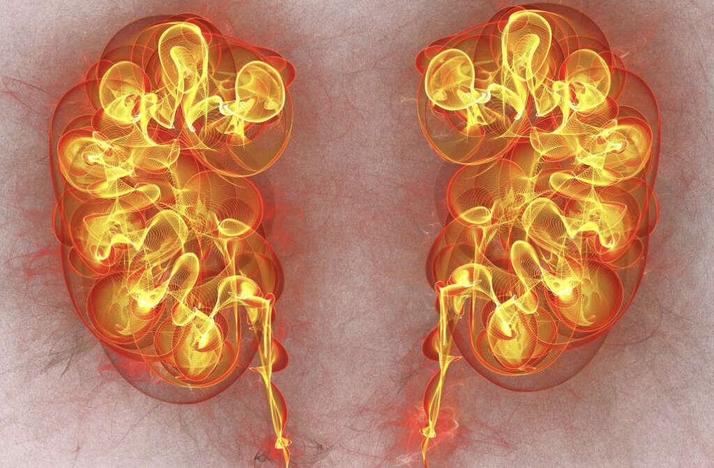 Sarcopenia