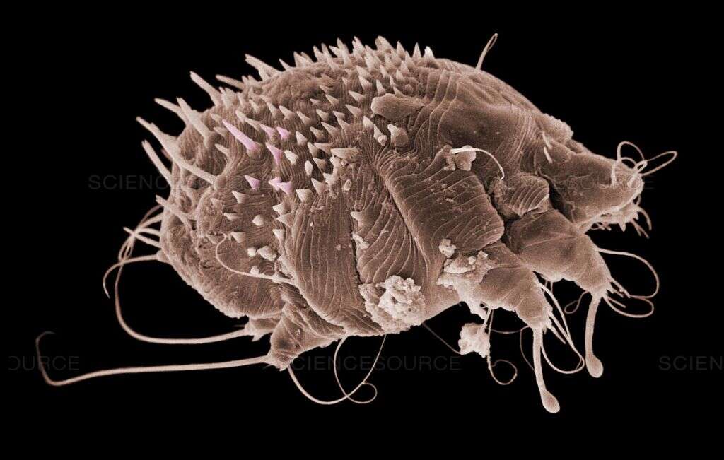 Scabies