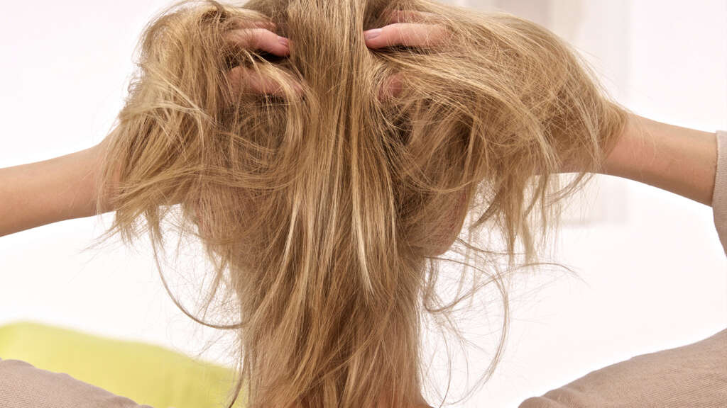 Scalp Psoriasis