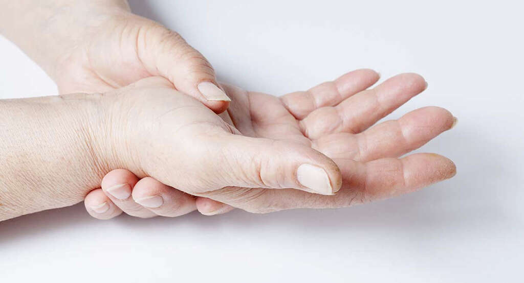 Scleroderma