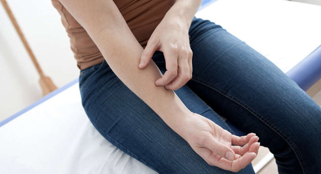 Scleroderma