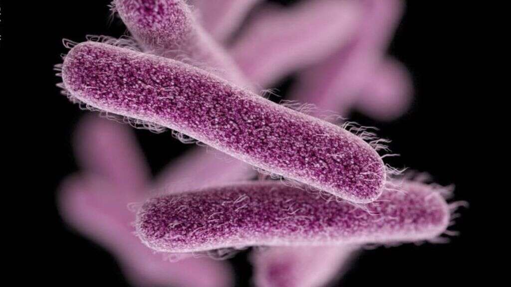 Shigellosis