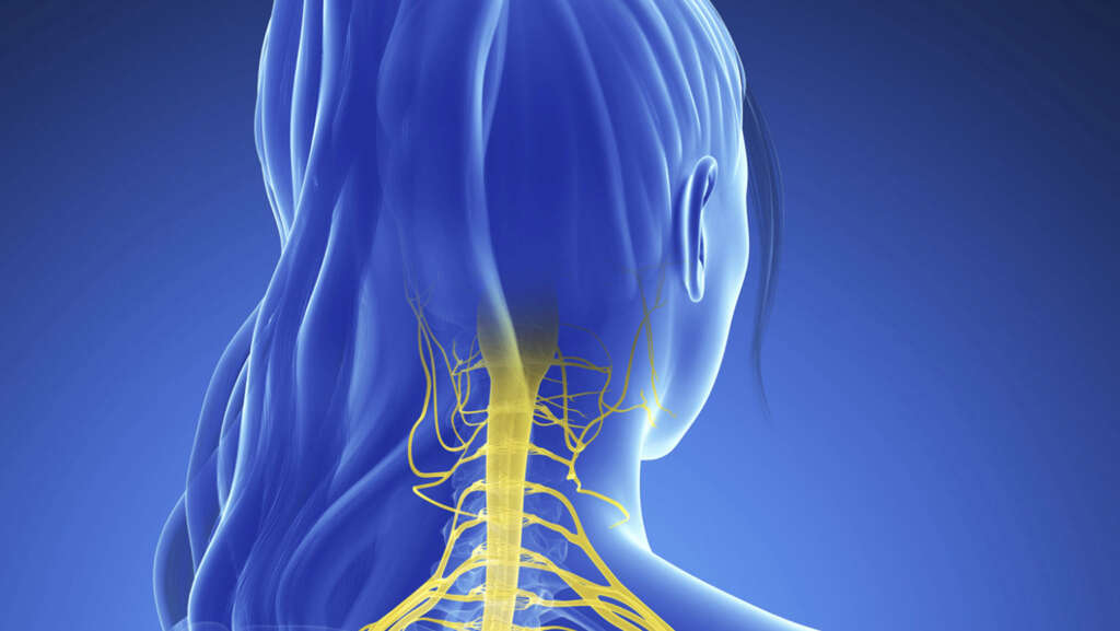 Sotos Syndrome