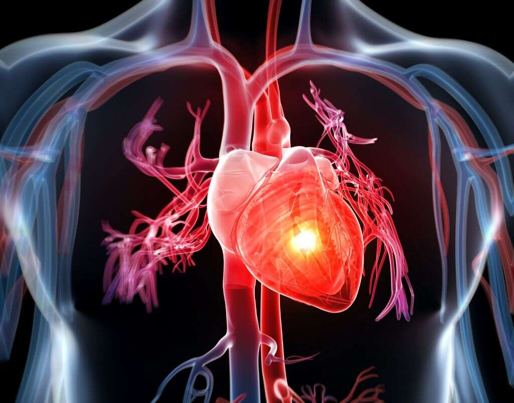 Stromme Syndrome