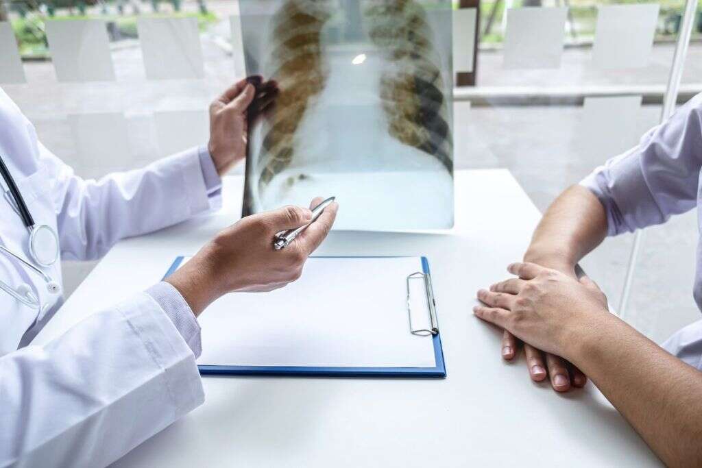Subcutaneous Emphysema