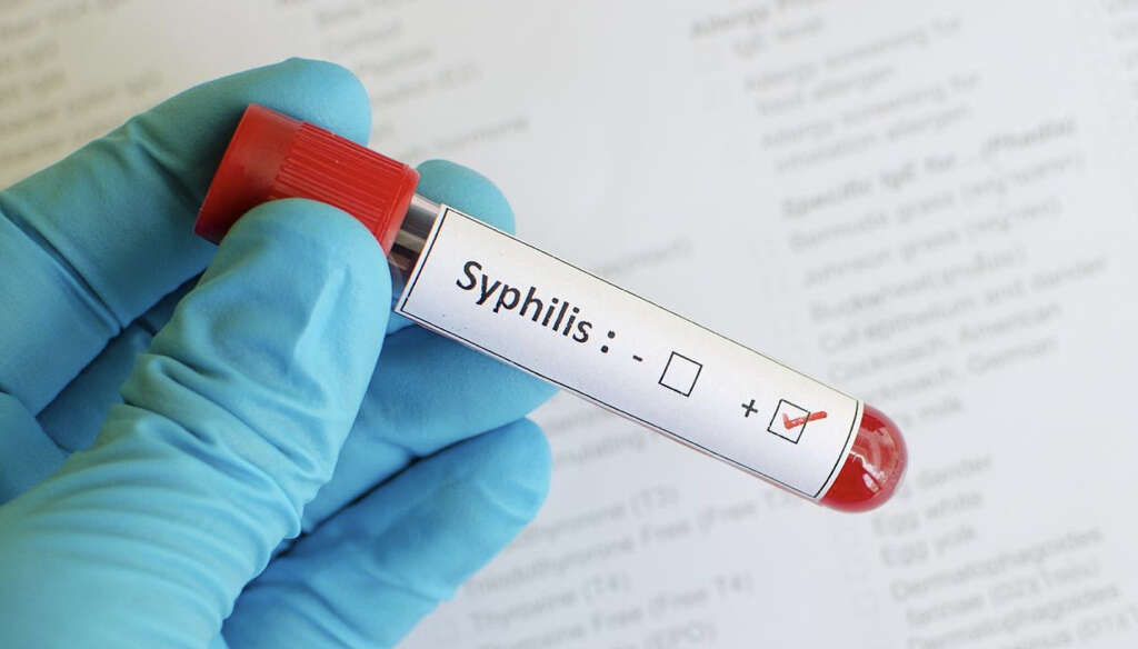 Syphilis