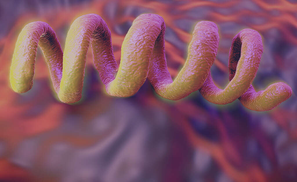 Syphilis