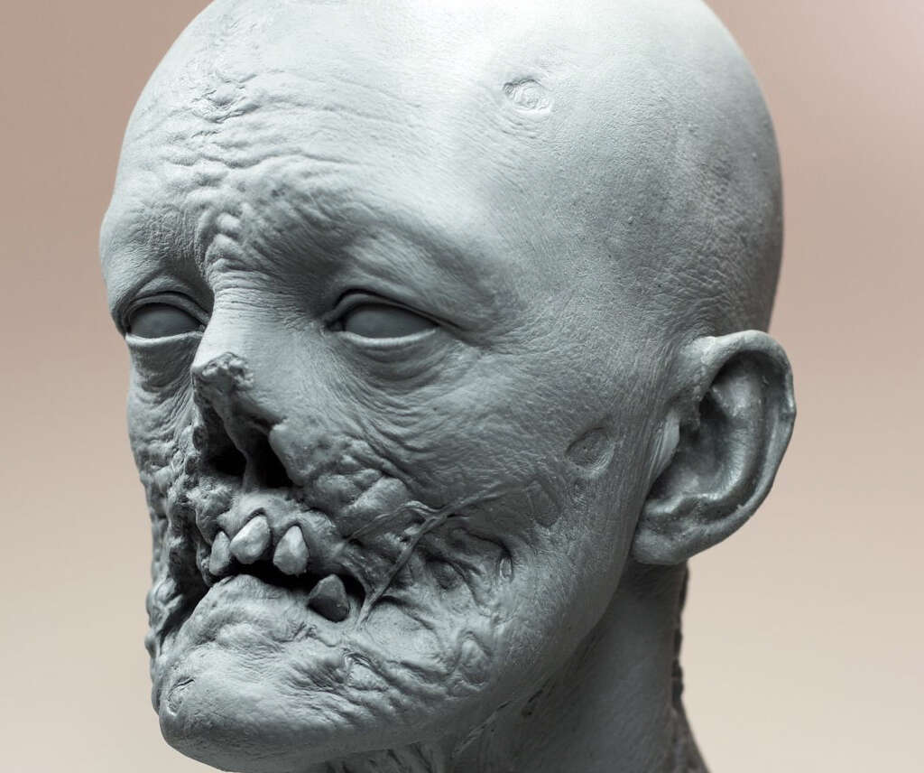Syphilis