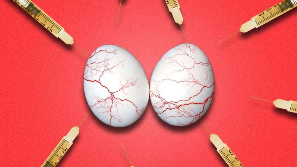 Testicular Atrophy