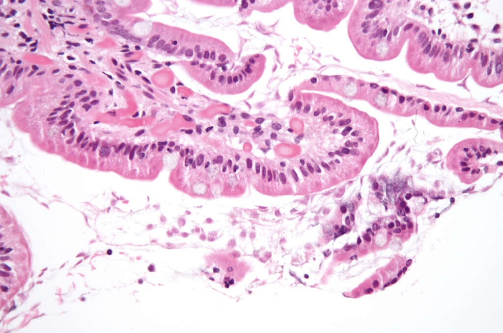 Duodenum