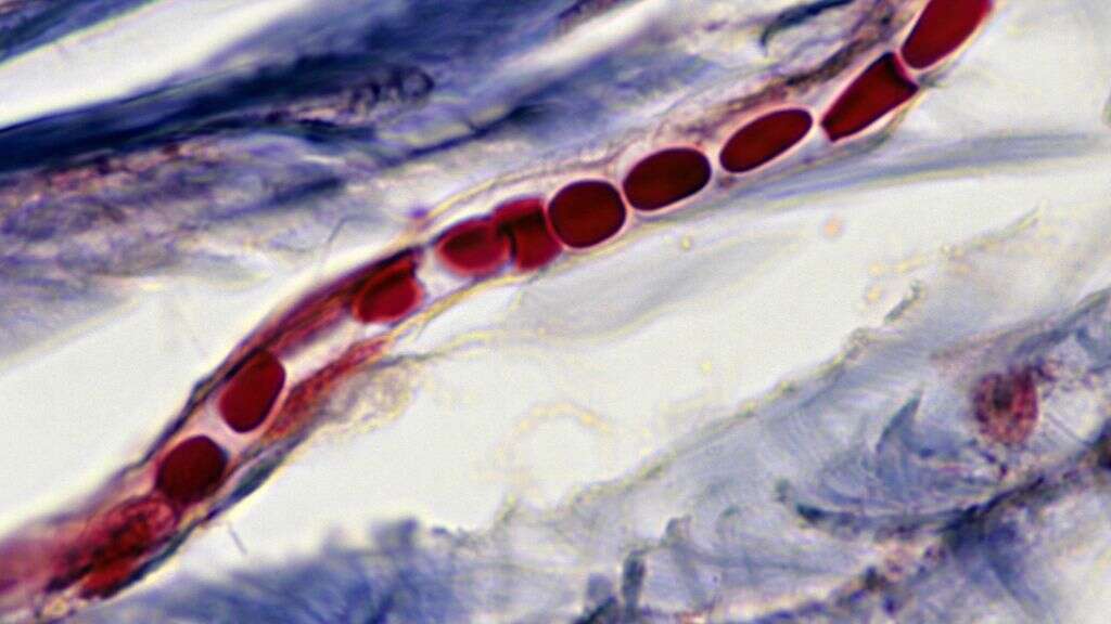 Lymphatic System