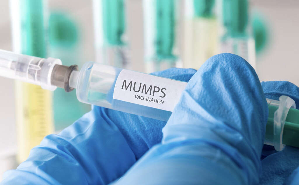 Mumps