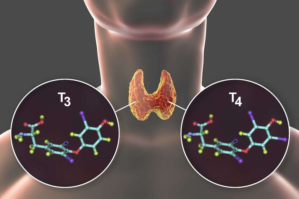 Thyroid Cancer