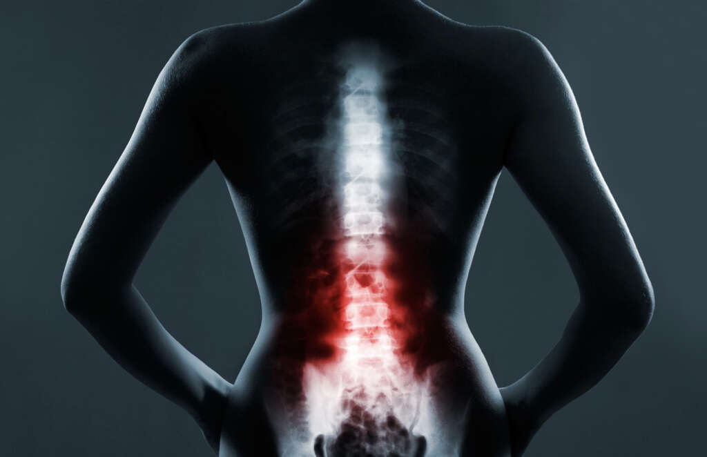 Transverse Myelitis