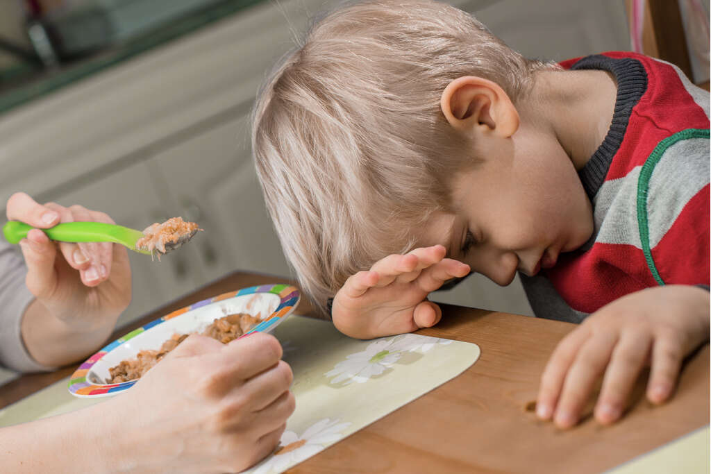 Treacher Collins Syndrome