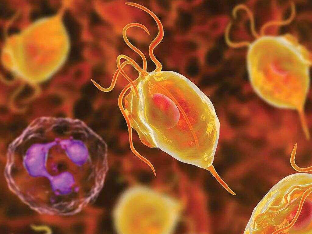 Trichomoniasis