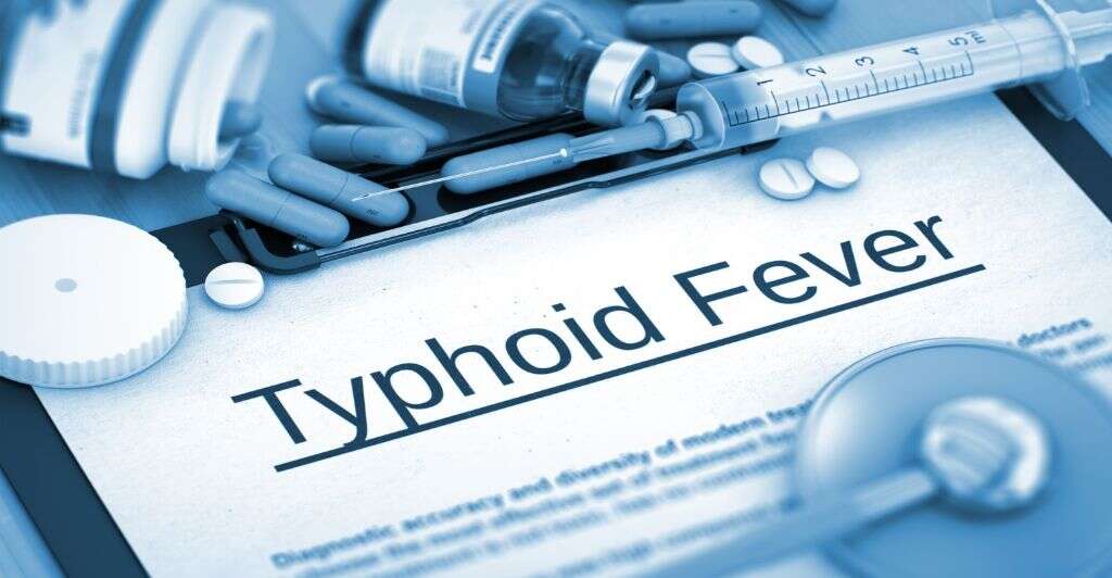 Typhus Fever