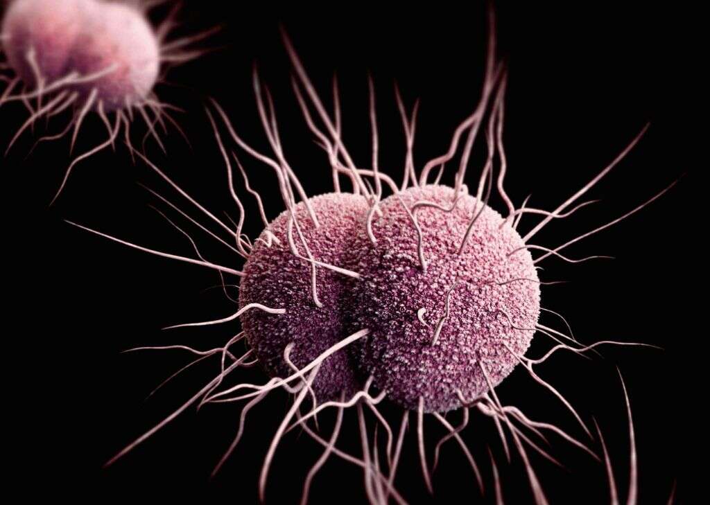 Urethritis