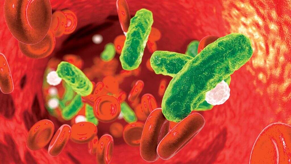Urethritis