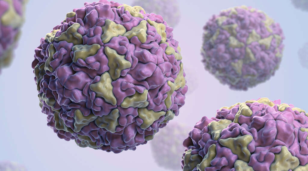 Viral Meningitis