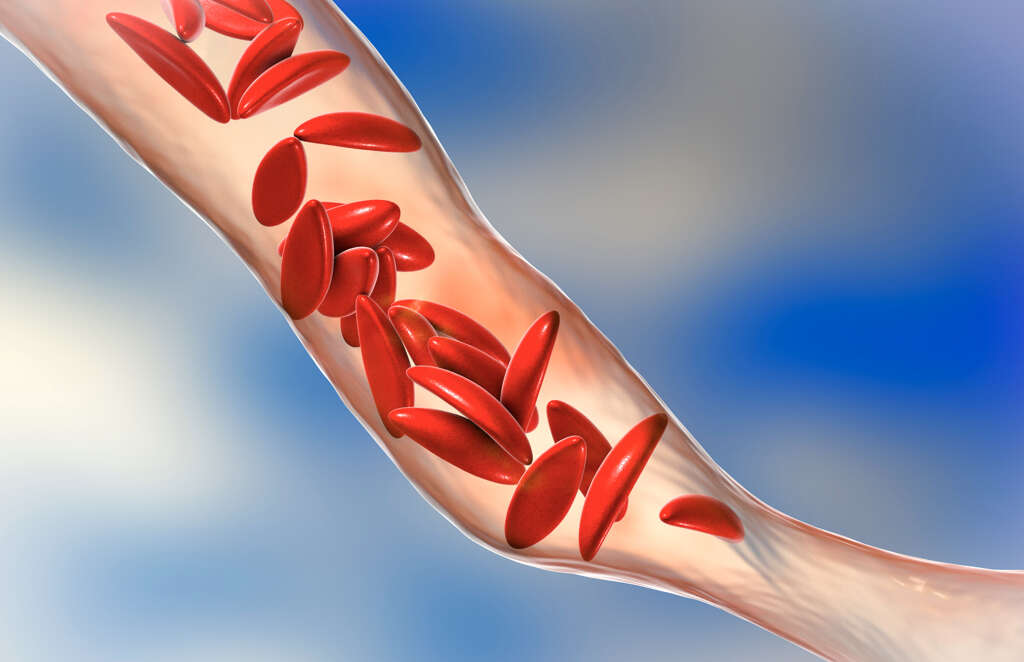 Wilson's Disease