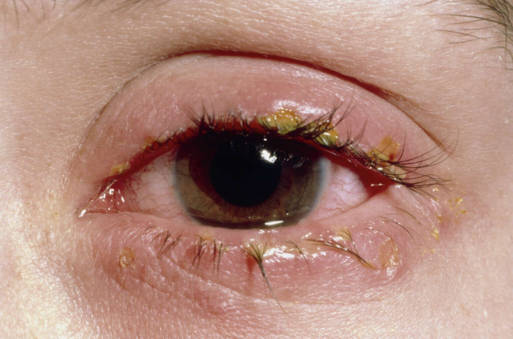 Red Eyes